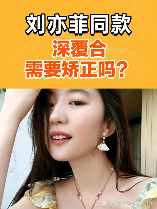 明星在哪矫正牙齿-图3