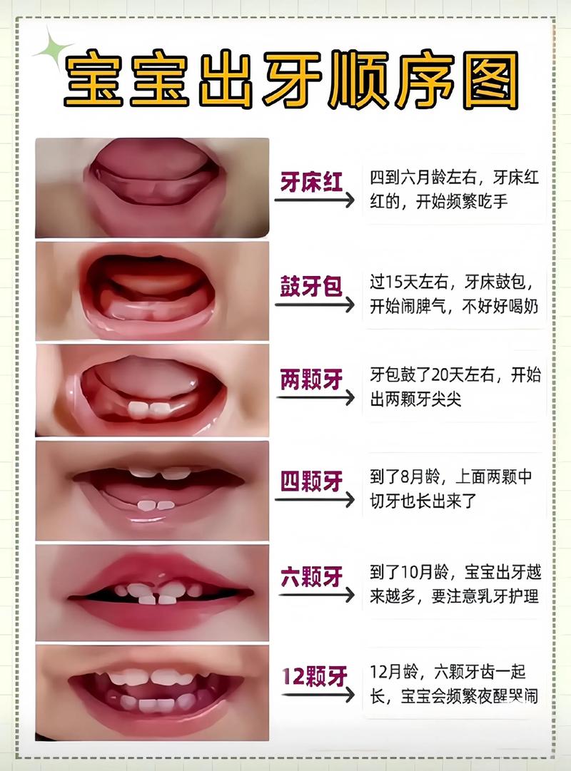 娃娃几岁矫正牙齿-图2 娃娃几岁矫正牙齿-图2