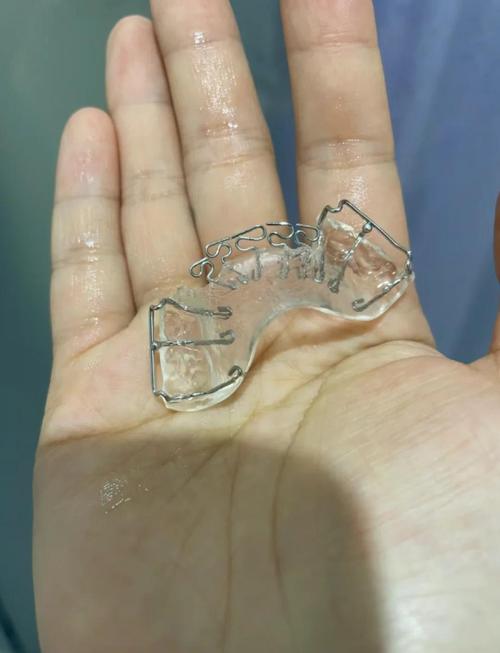 上海牙齿矫正最好怎么选?关键评判标准有哪些?-图2 上海牙齿矫正最好怎么选?关键评判标准有哪些?-图2