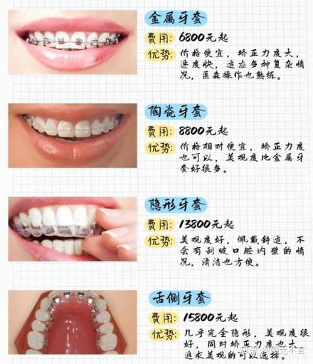 在哪牙齿矫正便宜-图3