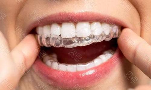 新疆牙齿矫正去哪里做？有哪些靠谱机构值得推荐？-图2