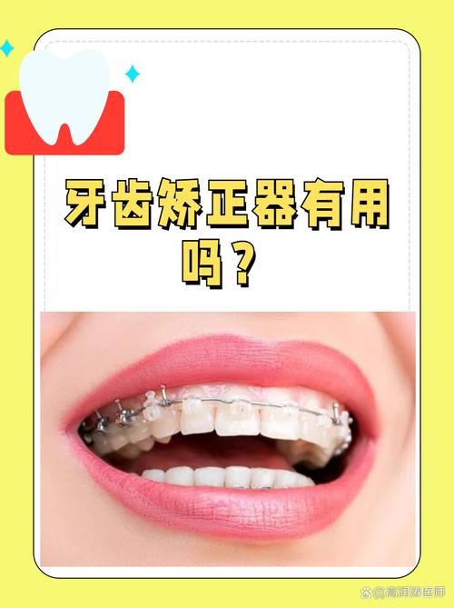 沈阳哪有矫正牙齿-图3