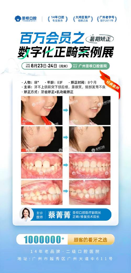 矫正牙齿能改善面容外突的脸型问题吗？-图3