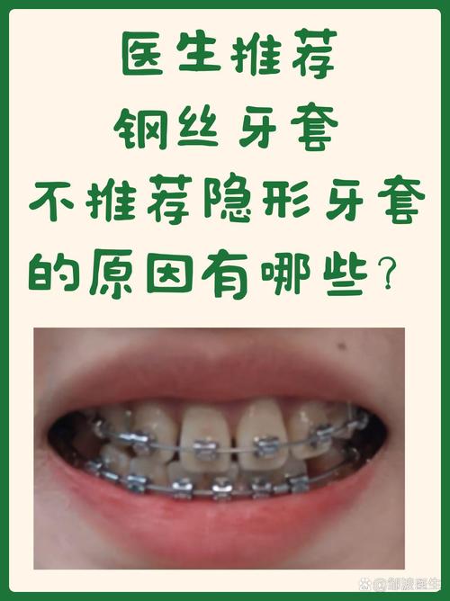 隐形矫正牙齿推荐，怎么选品牌才靠谱？-图2