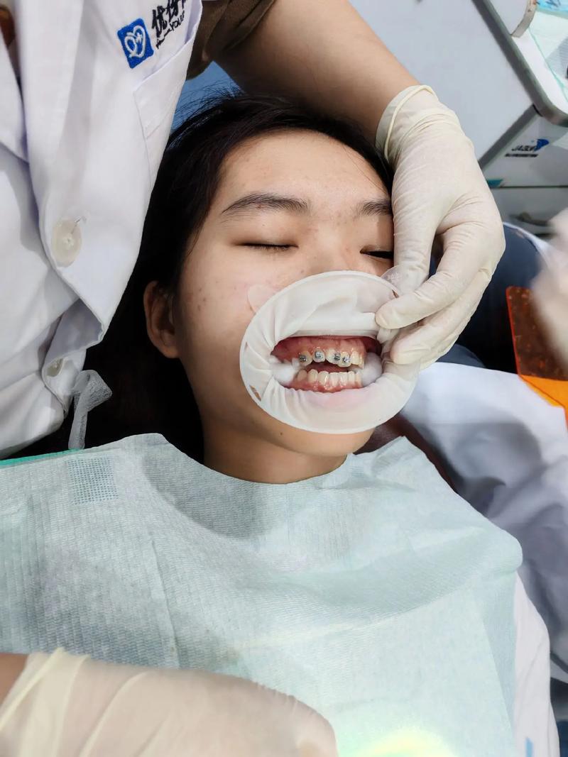 武汉卫校学生矫正牙齿,医院怎么选?费用和流程如何?-图1 武汉卫校学生矫正牙齿,医院怎么选?费用和流程如何?-图1
