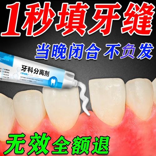 南京矫正牙齿材料怎么选？不同材料效果差多少？-图3