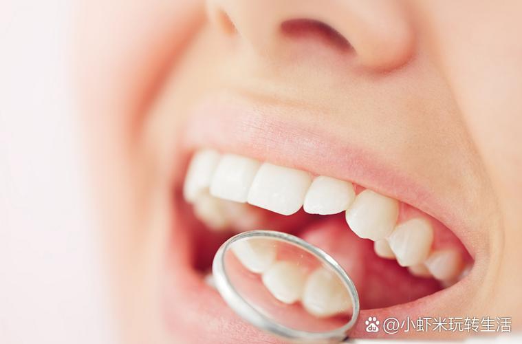 南京矫正牙齿材料怎么选？不同材料效果差多少？-图2