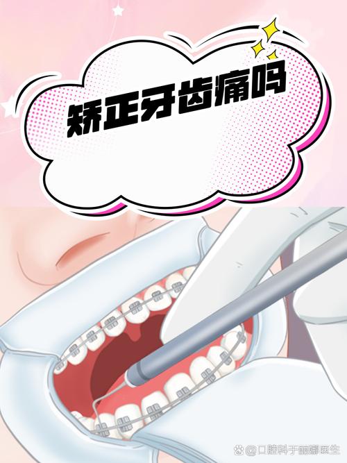 矫正牙齿牙疼？常见原因有哪些？-图2