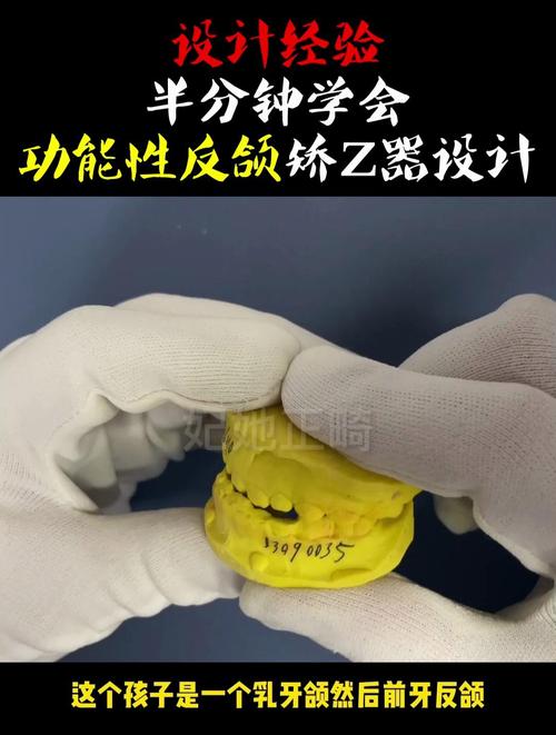 牙齿矫正导板图片能看出矫正效果吗?-图2 牙齿矫正导板图片能看出矫正效果吗?-图2