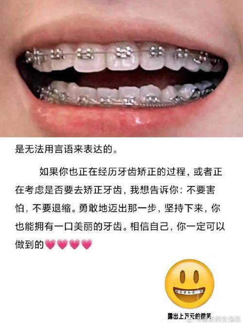 贵阳牙齿矫正怎么样?价格效果机构如何选?-图2 贵阳牙齿矫正怎么样?价格效果机构如何选?-图2