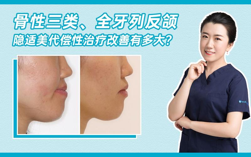 牙齿矫正美学矫正-图2 牙齿矫正美学矫正-图2