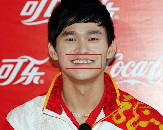 孙杨矫正牙齿图片曝光?他矫正牙齿的原因和效果如何?-图2 孙杨矫正牙齿图片曝光?他矫正牙齿的原因和效果如何?-图2