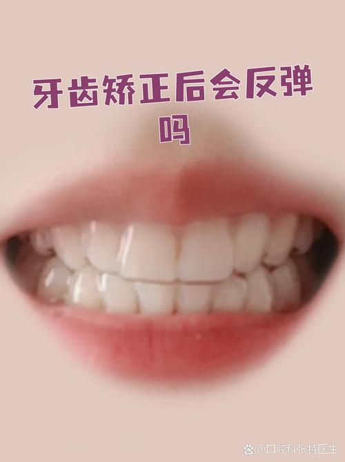 矫正牙齿反弹大吗-图3