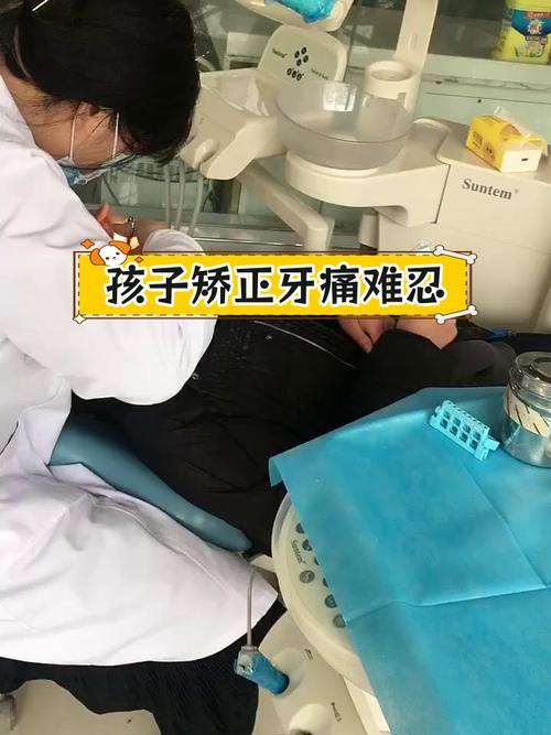 矫正牙齿有多痛苦-图2