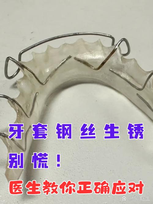 矫正牙齿钢丝脱落-图1