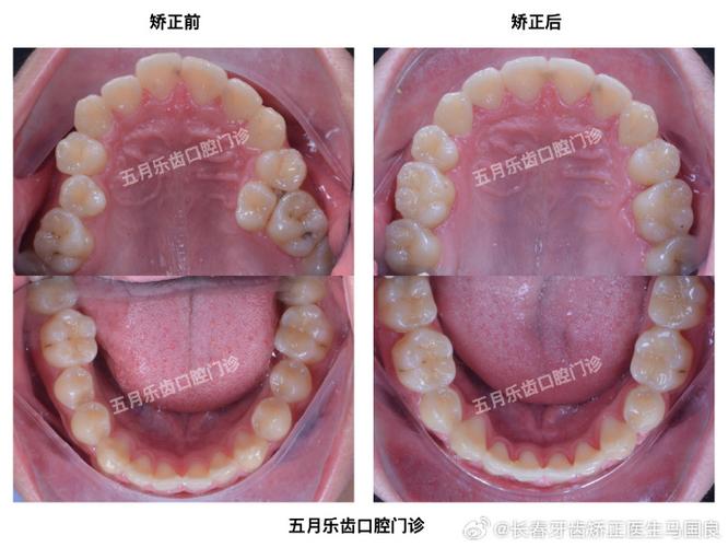 长春矫正牙齿去哪里找专业靠谱的机构？-图2