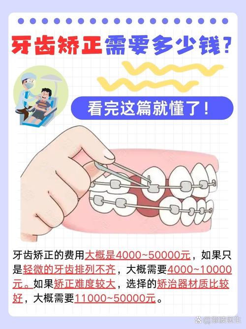 矫正牙齿怎么付费？支付方式有哪些？-图2