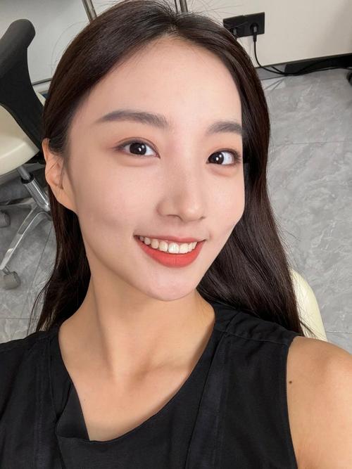 牙齿矫正 33岁-图2 牙齿矫正 33岁-图2