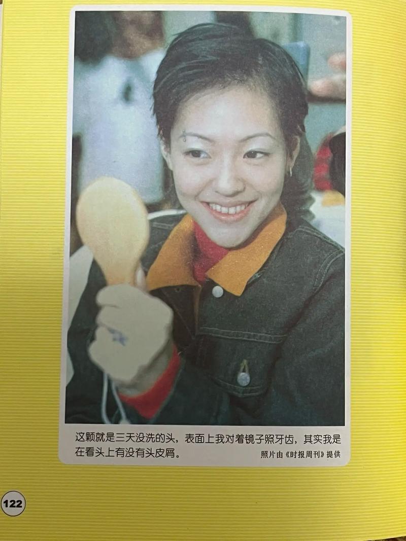 小s牙齿矫正日记记录了哪些矫正细节和效果？-图1