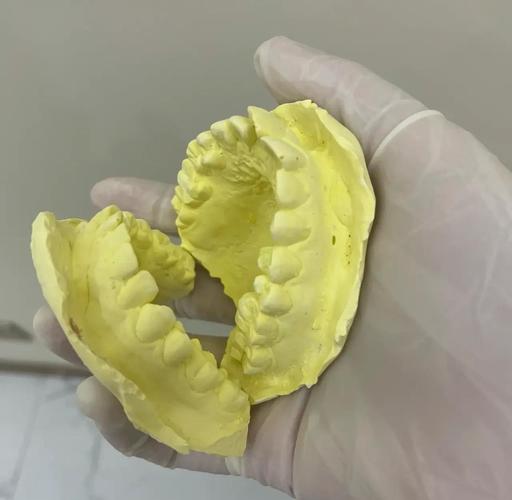 小s牙齿矫正日记记录了哪些矫正细节和效果？-图2