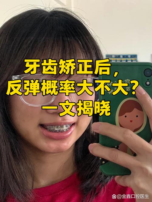 矫正牙齿后,为何会反弹回去?-图1 矫正牙齿后,为何会反弹回去?-图1