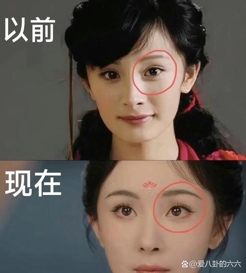 杨幂牙齿矫正前后变化有多大？-图1