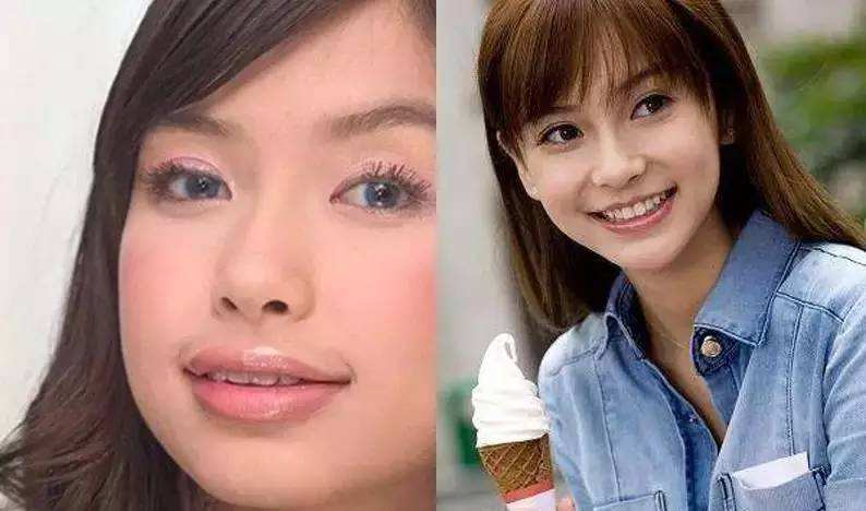 杨颖牙齿矫正前后颜值变化大吗？效果引网友热议！-图1