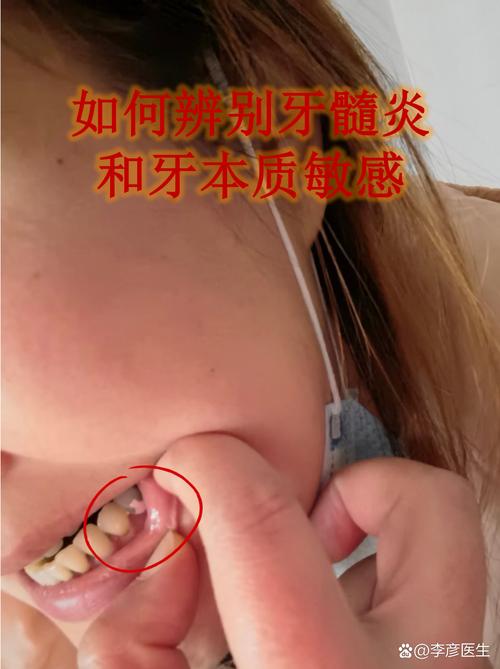 矫正牙齿磨牙会痛吗?疼痛感强吗?能忍受吗?-图1 矫正牙齿磨牙会痛吗?疼痛感强吗?能忍受吗?-图1