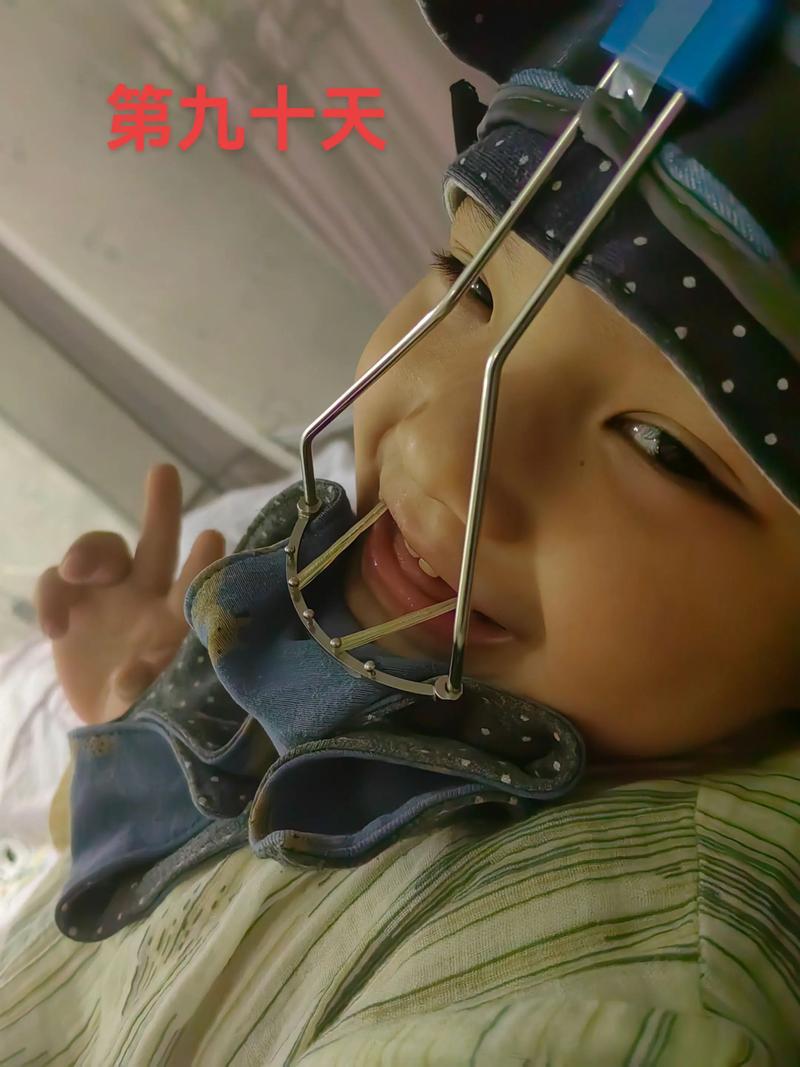 牙齿矫正后悔哭？后悔效果不如预期？还是过程太痛苦？-图3