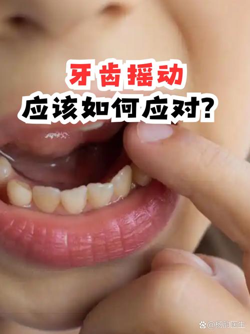 牙齿矫正门牙摇动是正常现象吗?需要处理吗?-图1 牙齿矫正门牙摇动是正常现象吗?需要处理吗?-图1