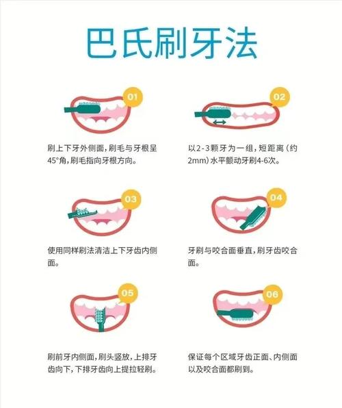 牙齿矫正期间，如何正确刷牙才能有效清洁？-图2