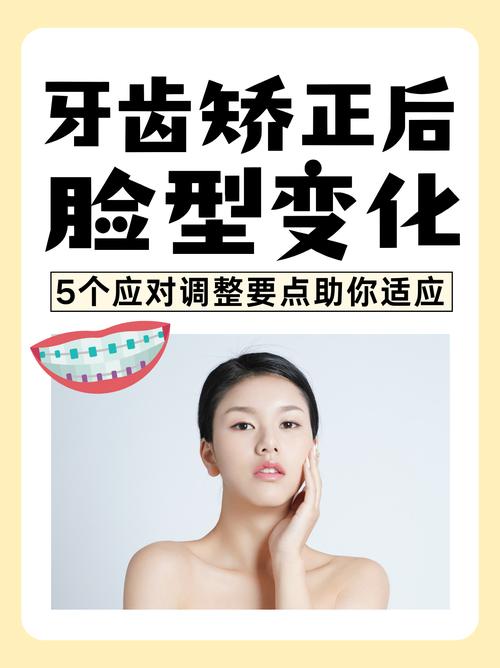 矫正牙齿真能变美?效果与代价你了解吗?-图3 矫正牙齿真能变美?效果与代价你了解吗?-图3