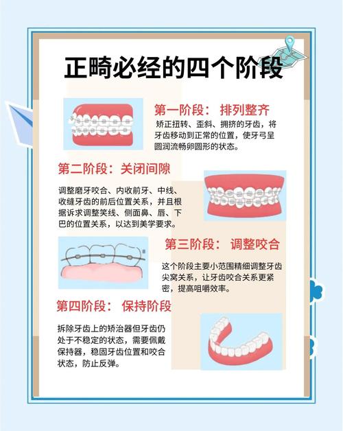 牙齿矫正过程多久-图2 牙齿矫正过程多久-图2
