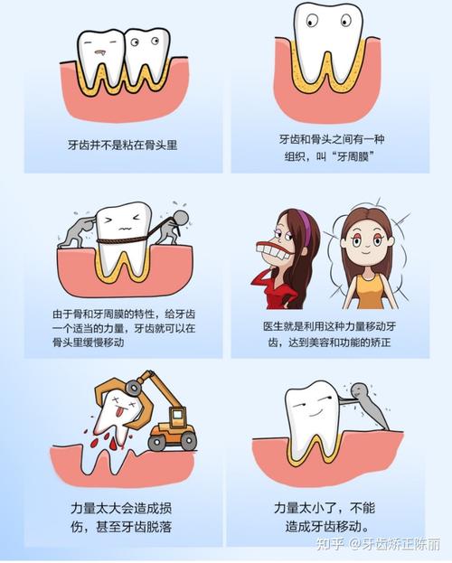 成人牙齿矫正的原理是什么？牙齿移动的科学机制究竟是什么？-图2