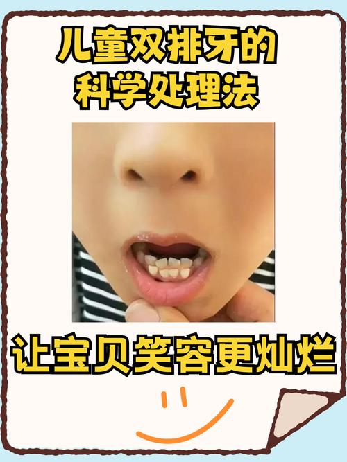 双层牙齿后期矫正-图2