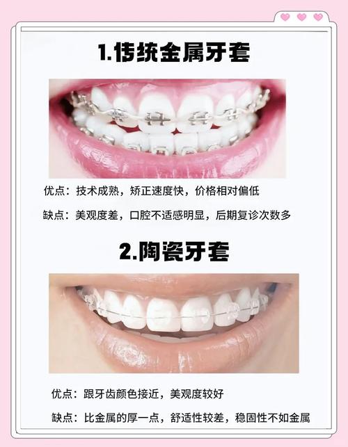 牙齿手术矫正有哪些常见种类?不同类型适用哪些牙齿问题?-图1 牙齿手术矫正有哪些常见种类?不同类型适用哪些牙齿问题?-图1