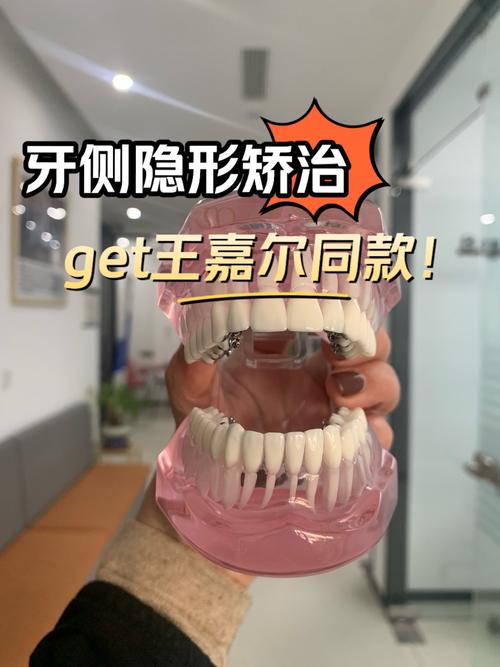 宁波隐形牙齿矫正-图1 宁波隐形牙齿矫正-图1