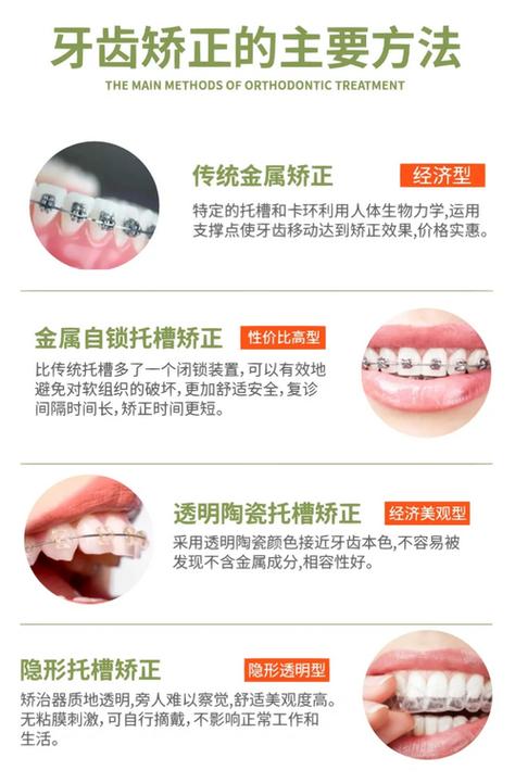 武汉矫正牙齿排行靠谱吗？哪家医院医生好？-图3