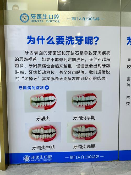 矫正牙齿后,矫正器摘掉后牙齿还需要洗牙吗?-图1 矫正牙齿后,矫正器摘掉后牙齿还需要洗牙吗?-图1