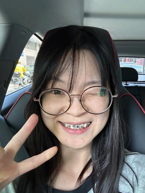 牙齿矫正后脸变歪？是矫正方式不当还是其他原因造成的？-图1