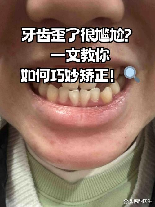 牙齿矫正后脸变歪？是矫正方式不当还是其他原因造成的？-图2