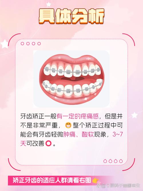 牙齿矫正为什么痛-图1 牙齿矫正为什么痛-图1