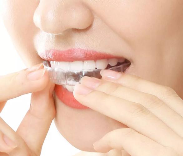 佳德口腔矫正牙齿效果好吗?适合哪些人?-图1 佳德口腔矫正牙齿效果好吗?适合哪些人?-图1