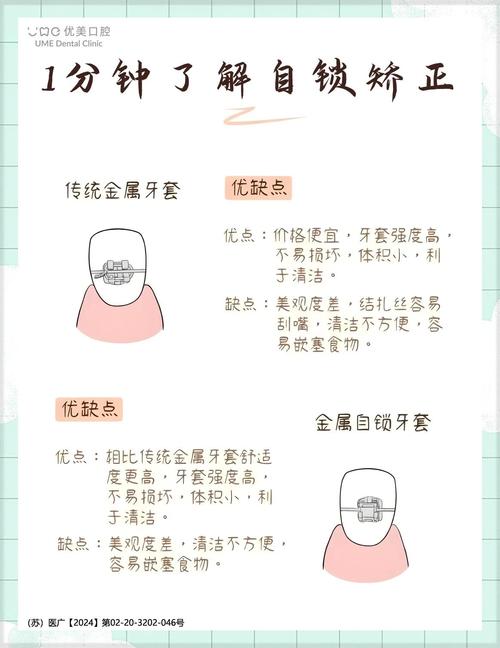 牙齿矫正的自锁原理是什么?它如何实现高效精准矫正?-图3 牙齿矫正的自锁原理是什么?它如何实现高效精准矫正?-图3