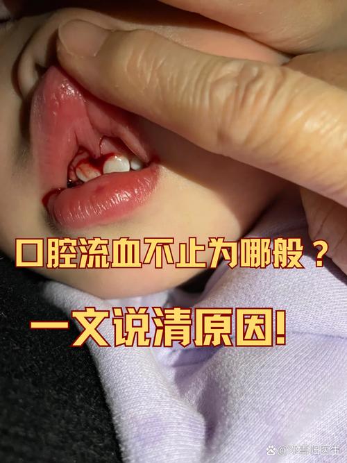 矫正牙齿牙龈出血，是正常现象吗？-图2