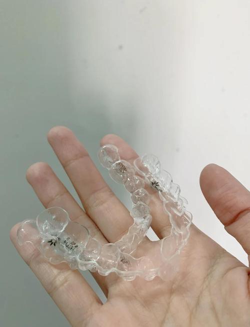 菏泽隐形牙齿矫正效果如何？价格贵不贵？适合哪些人？-图1