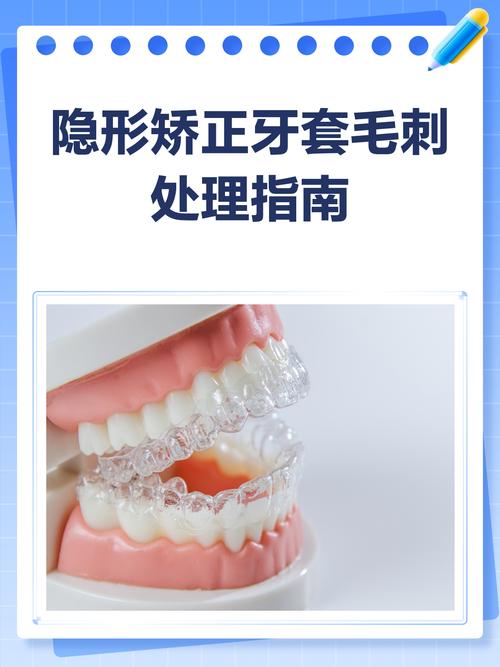 南宁隐形牙齿矫正效果如何?需要多久完成?-图2 南宁隐形牙齿矫正效果如何?需要多久完成?-图2