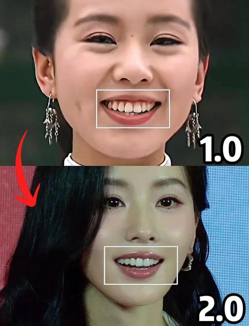 明星矫正牙齿一般多大年龄开始矫正比较好?-图3 明星矫正牙齿一般多大年龄开始矫正比较好?-图3