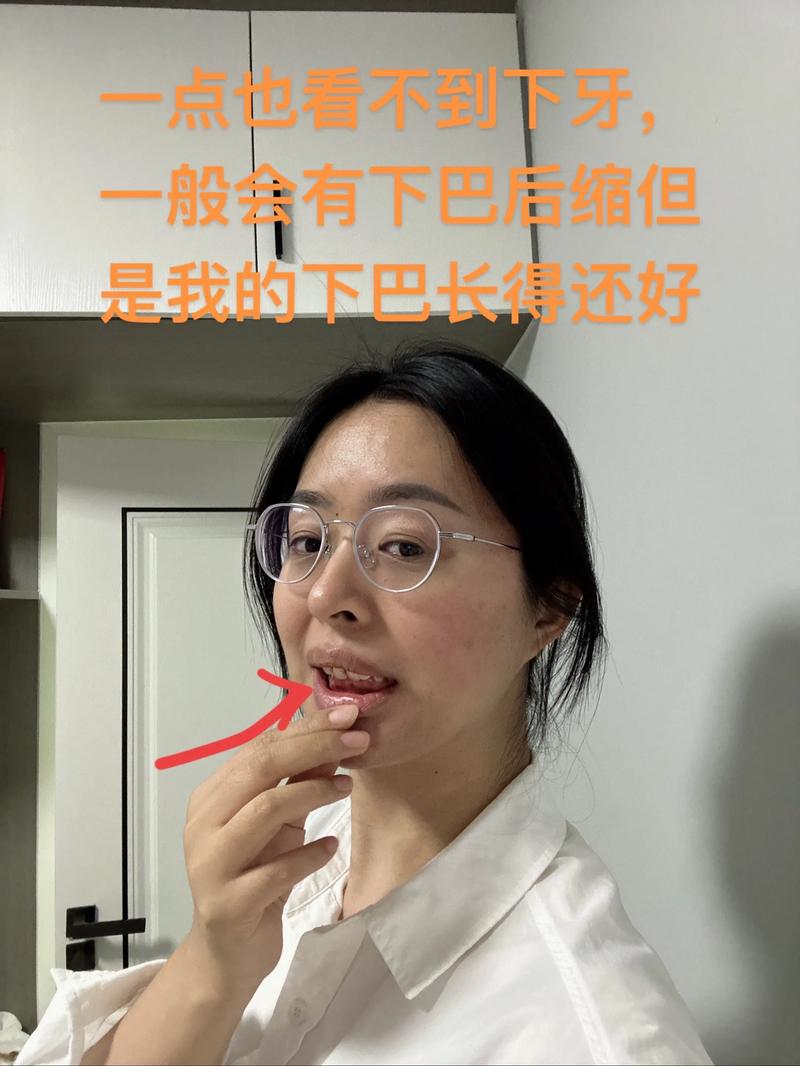 做牙齿矫正真的会有危害吗？这些潜在风险需警惕-图1