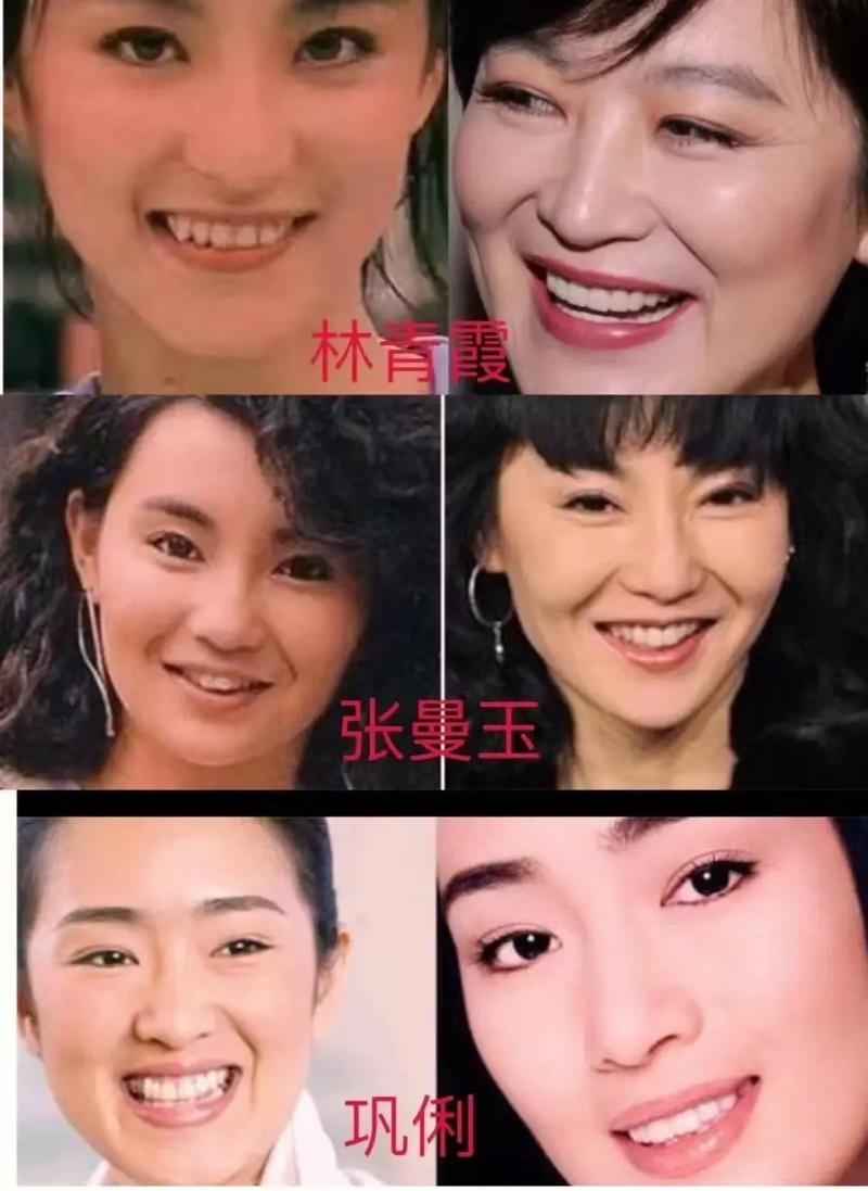 为何成年明星纷纷选择矫正牙齿？年龄是影响因素吗？-图2
